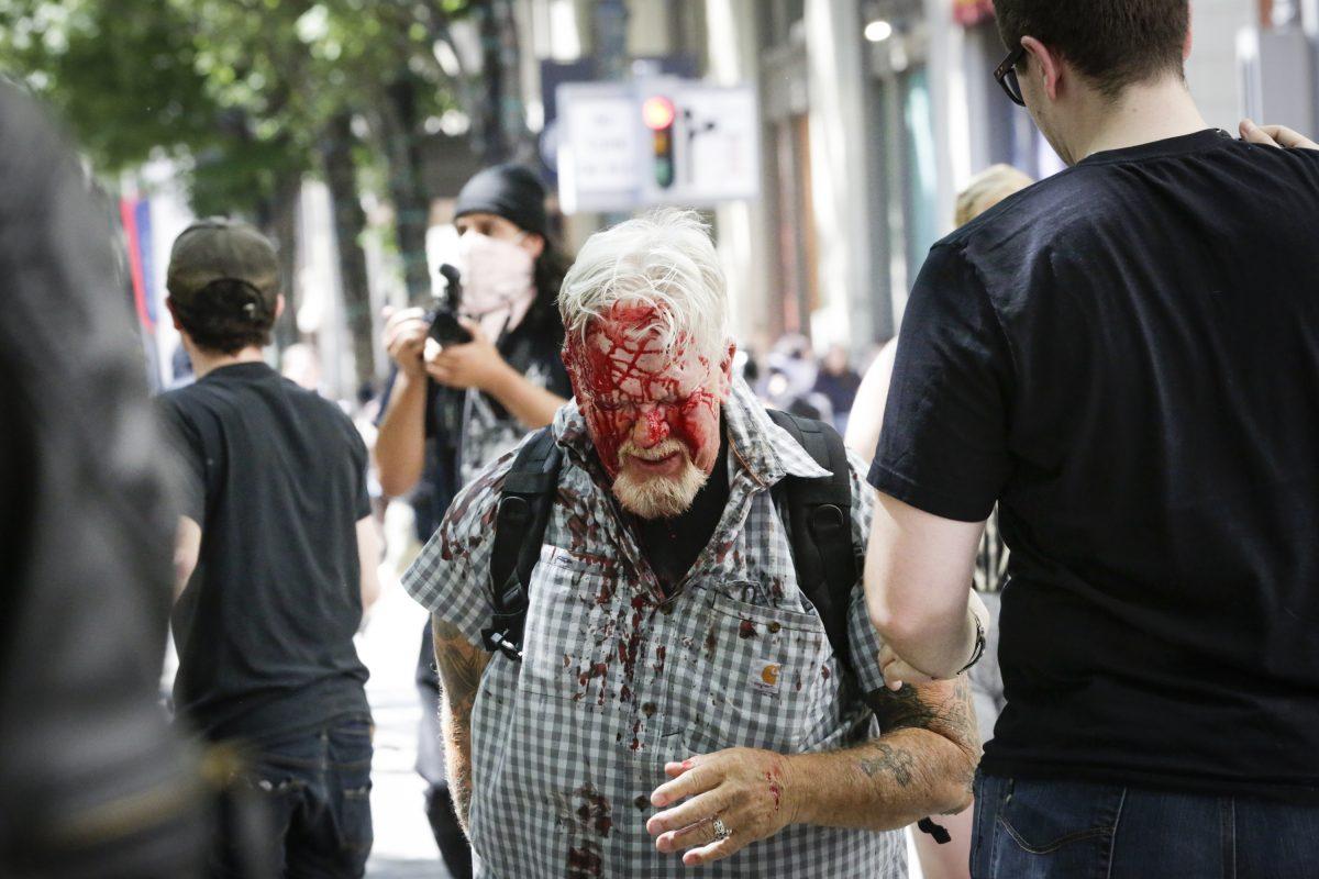 An unidentified man injured by Antifa extremists at Pioneer Courthouse Square on June 29, 2019. (Moriah Ratner/Getty Images)
