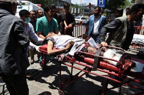 An injured Afghan man lies on a stretcher en route to an Italian aid hospital after a car bomb attack in Kabul on July 1, 2019. (WAKIL KOHSAR/AFP/Getty Images)