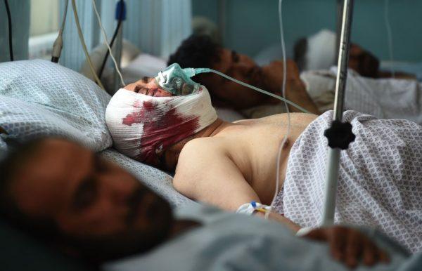 Wounded Afghan men receive treatment at the Wazir Akbar Khan hospital following a car bomb attack in Kabul on July 1, 2019. (WAKIL KOHSAR/AFP/Getty Images)