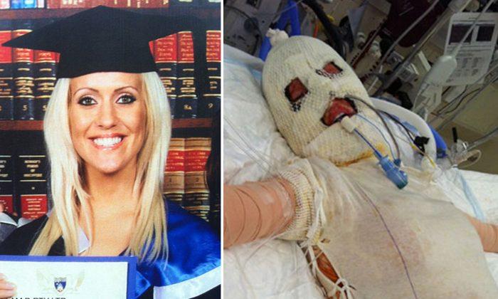 Lady Brutally Burned Alive. 3 Years Later, She Removed Mask to Reveal Her Perfect Face