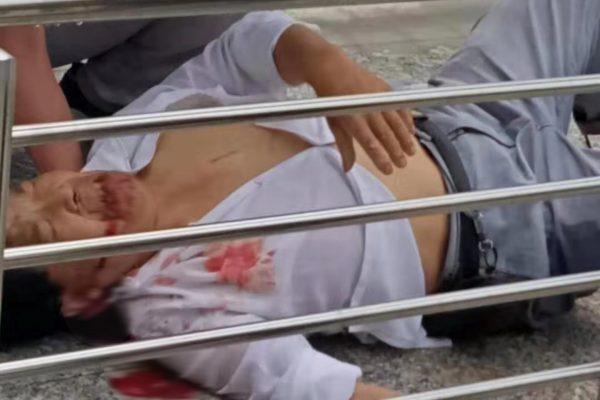 An injured man in the blast on July 26, 2019. (Provided to The Epoch Times by interviewee)