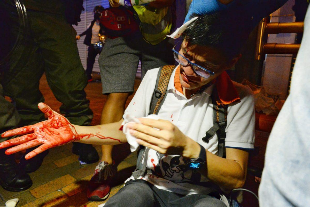 A protester was injured in the head after police fired tear gas and rubber bullets near Des Voeux Road West, in Hong Kong, on July 28, 2019. (Song Bilong/The Epoch Times)