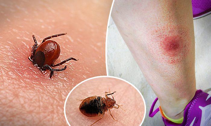 10 Common Insect Bites: What to Expect, and How Recognize & Treat Them