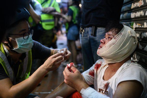 An injured man is attended to as he sits on the street after a clash during a protest in Tsuen Wan district of Hong Kong on Aug. 5, 2019. (Philip Fong/AFP/Getty Images)