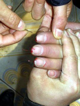 Torture reenactment: Inserting needles under the fingernails. (Minghui.org)
