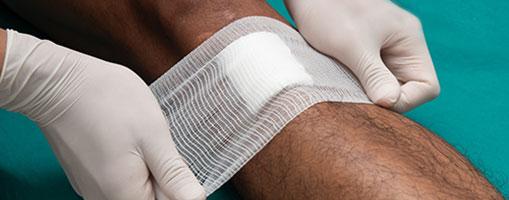 A leg gets bandaged in a file photo after a person contracts flesh-eating bacteria. Quick treatment is key. (CDC)