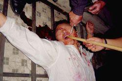 Torture reenactment: Prying open the mouth for force-feeding. (Minghui.org)