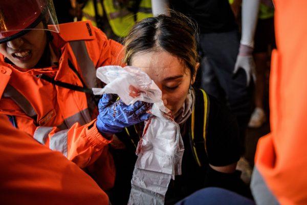 A woman received a facial injury during a standoff between protesters and police in Tsim Sha Tsui in Hong Kong on August 11, 2019, in the latest opposition to a planned extradition law that was quickly evolved into a wider movement for democratic reforms. (ANTHONY WALLACE/AFP/Getty Images)