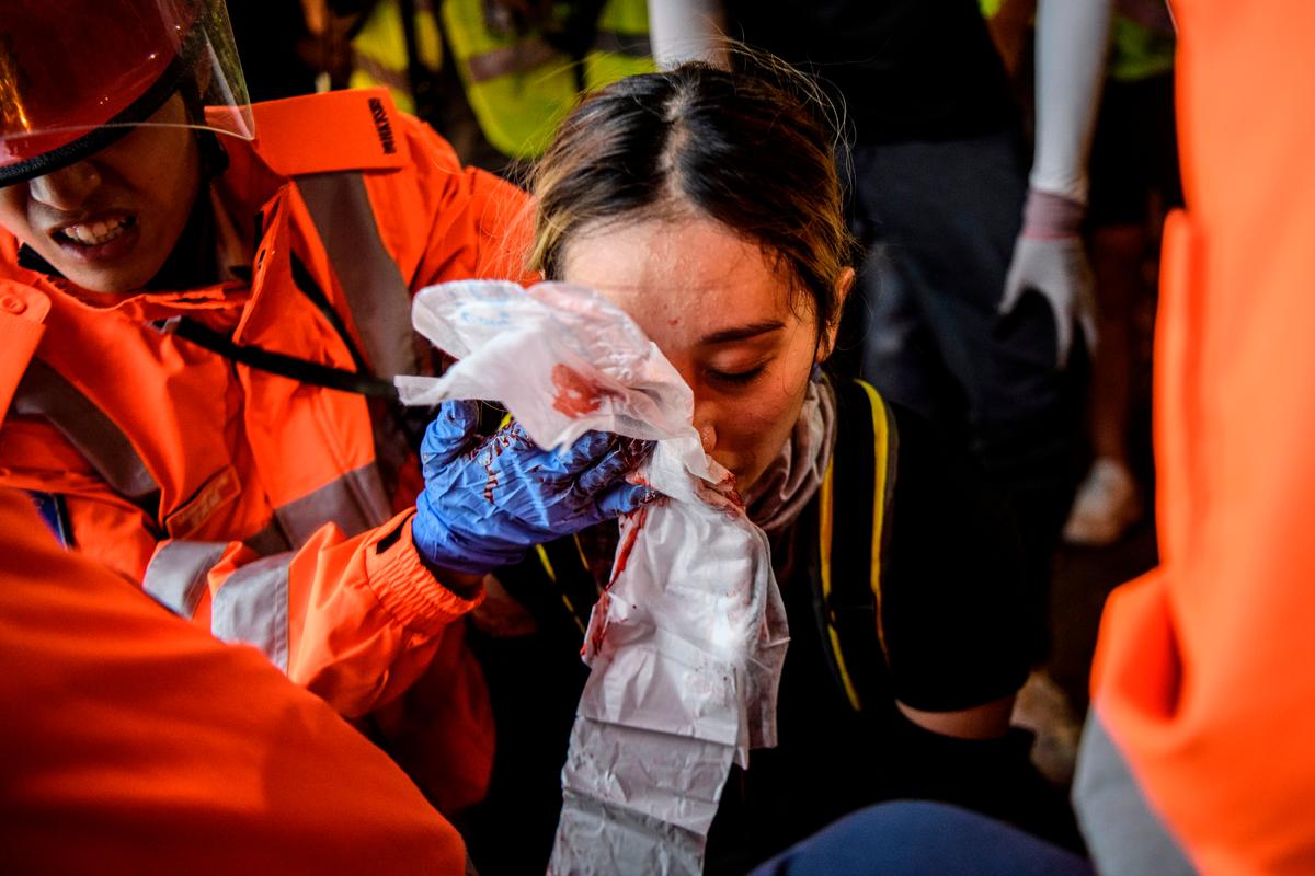 A woman received a facial injury during a standoff between protesters and police in Tsim Sha Tsui in Hong Kong on Aug. 11, 2019. (Anthony Wallace/AFP/Getty Images)