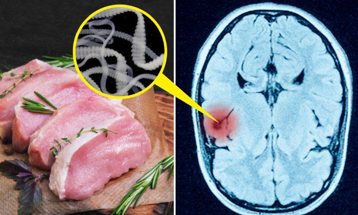 Teen Has Seizures and Dies, Then Doctors Find Tapeworm Eggs in His Body