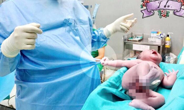 ‘Baby Strong’: Newborn Grabs Doctor’s Scrubs Right After Birth and Just Won’t Let Go
