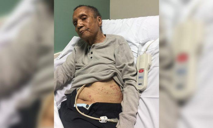 Air Force Veteran Covered in Ant Bites in His Final Days at VA Center, Says Daughter