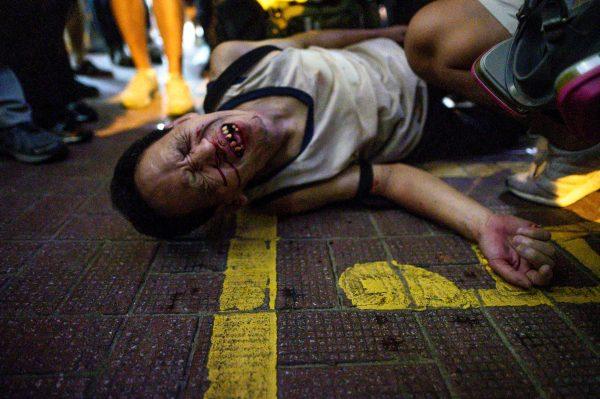 An unidentified man reacts after being beaten by a group of people after a protest in Causeway Bay district in Hong Kong on Sept. 15, 2019. (Philip Fong/AFP/Getty Images)
