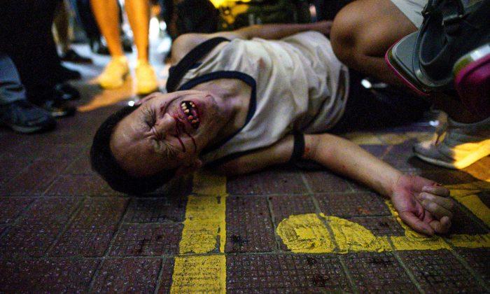 Hong Kong Police Accused of Discriminatory Treatment During Clashes Between Pro-Beijing and Pro-Democracy Protesters
