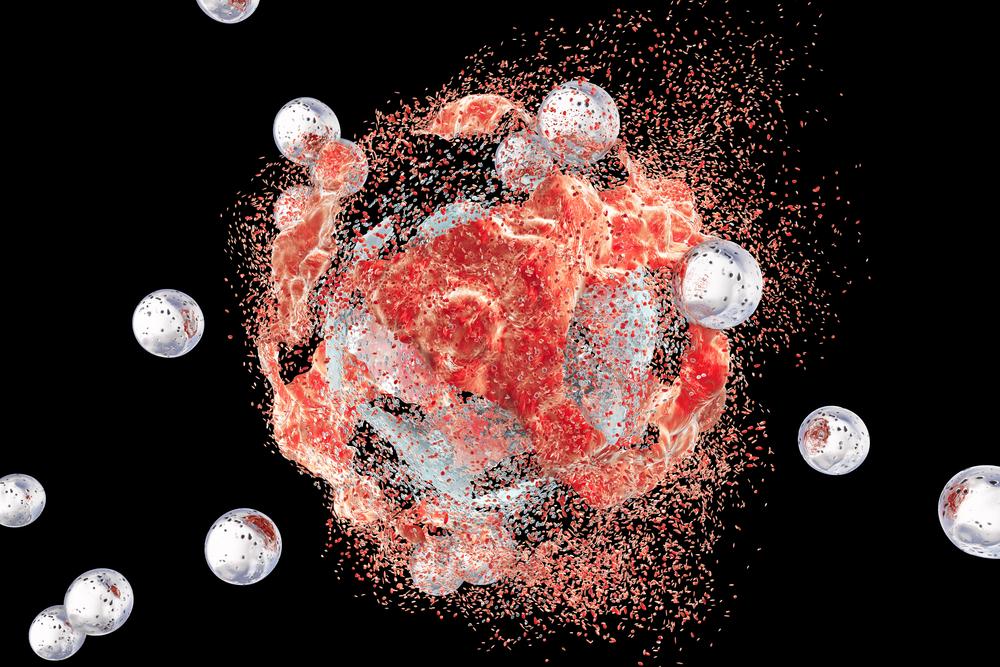 Illustration - Shutterstock | <a href="https://www.shutterstock.com/image-illustration/destruction-tumor-cell-by-nanoparticles-3d-446659117?src=IwIbVhQClKxuKuhquYJ7FA-1-8&studio=1">Kateryna Kon</a>