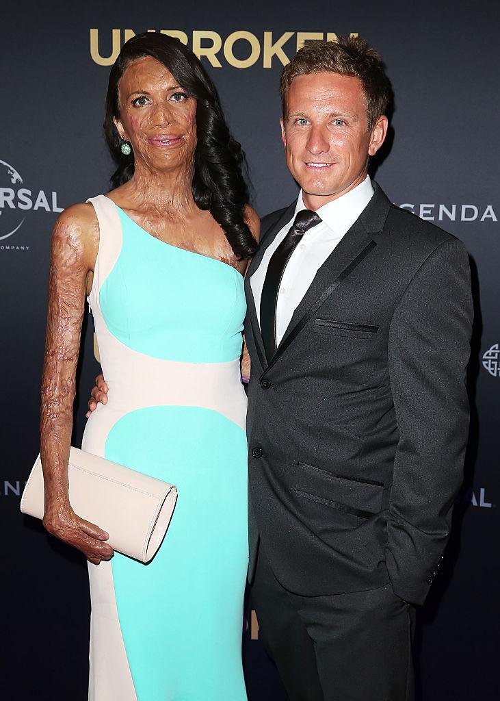 Turia Pitt and Michael Hoskin arrive at the world premiere of Unbroken at the State Theatre on Nov. 17, 2014, in Sydney, Australia. (©Getty Images | <a href="https://www.gettyimages.com/detail/news-photo/turia-pitt-and-michael-hoskin-arrive-at-the-world-premiere-news-photo/459112376?adppopup=true">Brendon Thorne</a>)