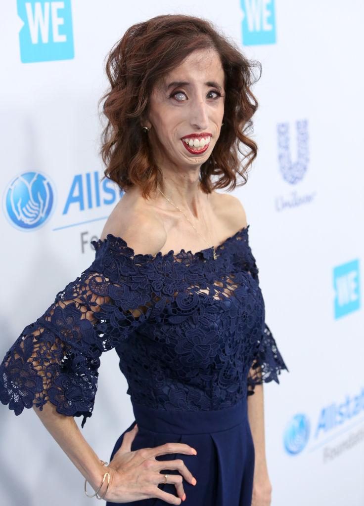 ©Getty Images | <a href="https://www.gettyimages.com/detail/news-photo/motivational-speaker-author-lizzie-velasquez-attends-we-day-news-photo/673931152?adppopup=true">Jesse Grant</a>