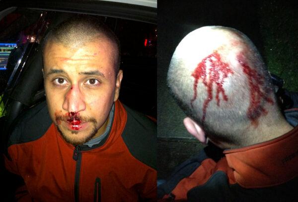 Photos of George Zimmerman taken shortly after his encounter with Trayvon Martin. (via Joel Gilbert)