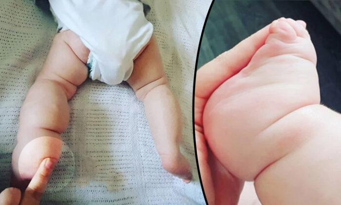 Mom Notices Baby Girl’s ‘Clubbed Foot,’ Fears the Worst–but It Wasn’t What She Expected