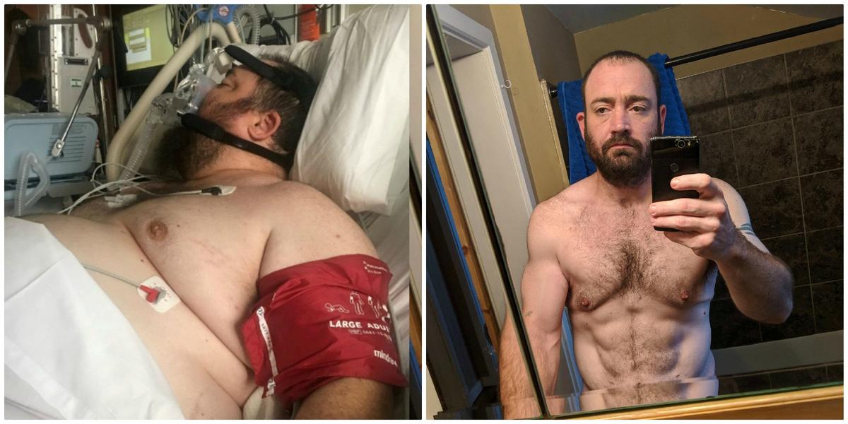 (L) Adam in the hospital before his dramatic weight-loss journey began in 2017; (R) currently in good shape in 2019. (SWNS)