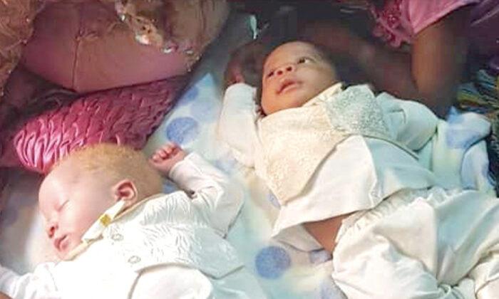 Mom Gives Birth to Rare Twins With Different Skin Colors, One Black and One White
