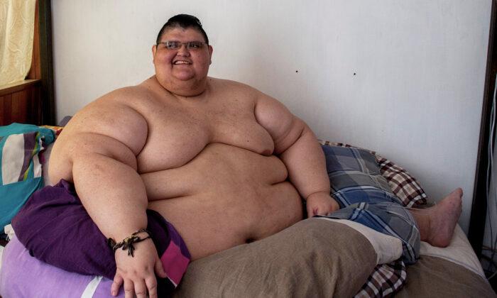 ‘World’s Fattest Man’ Loses 728 Pounds, Leaves Bed, Walks on Own 2 Feet for the First Time in 10 Years