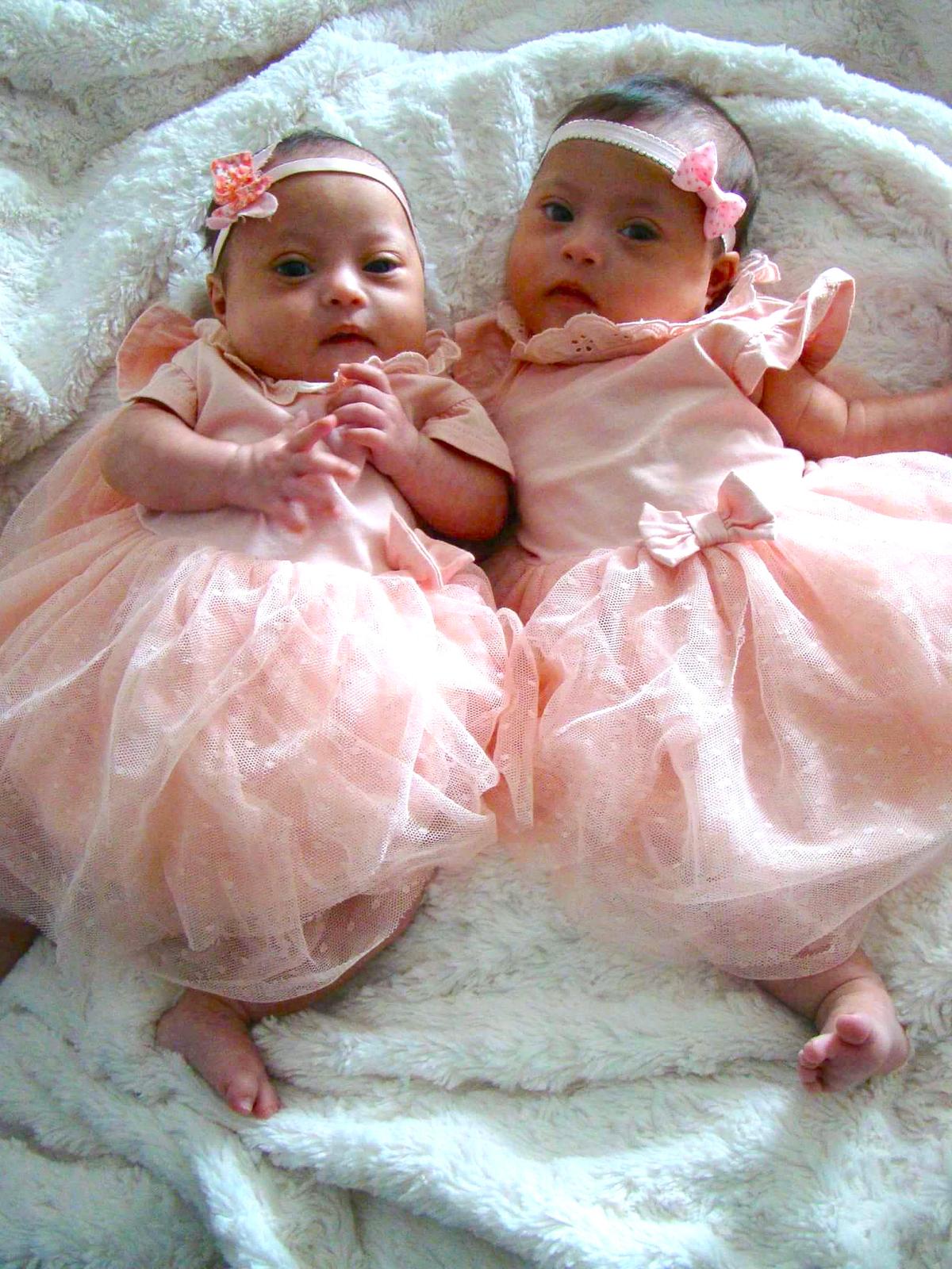 Twin girls, Hannah and Rachel both have Down syndrome. (SWNS)
