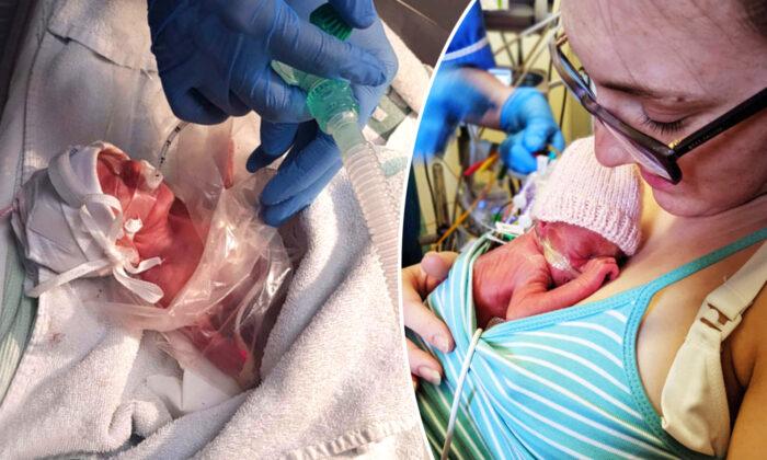 Preemie Born 4 Months Early Survives All Odds Despite Being Given 48 Hours to Live