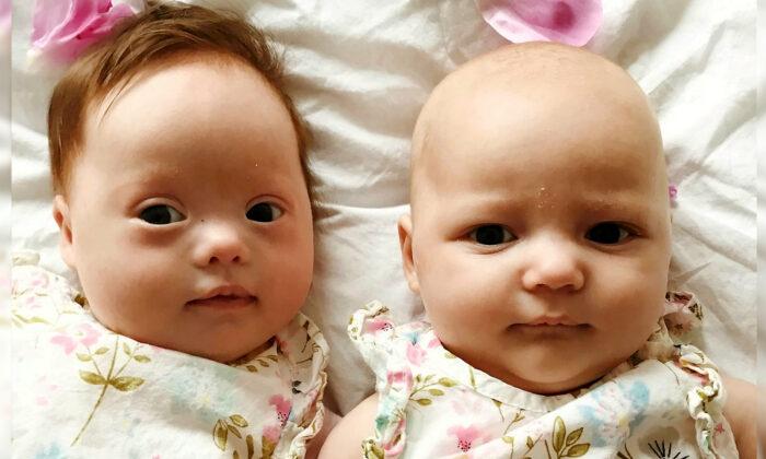 ‘One-in-a-Million’ Twins: One Born With Down Syndrome, and the Other Without