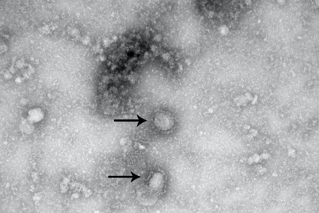 US Health Department Collaborating With Biotech Company to Create Coronavirus Treatment