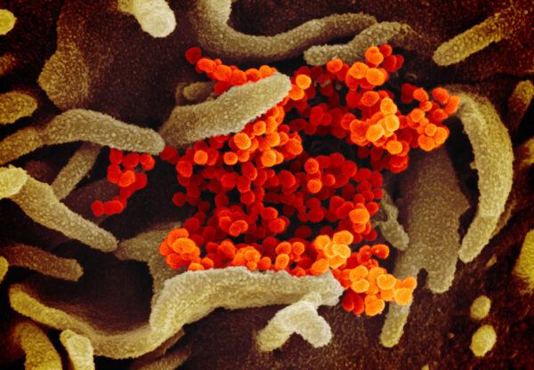 This scanning electron microscope image shows the virus that causes COVID-19 (orange) isolated from a patient in the United States, emerging from the surface of cells (green) cultured in a lab. (NIAID-RML/CC BY 2.0)