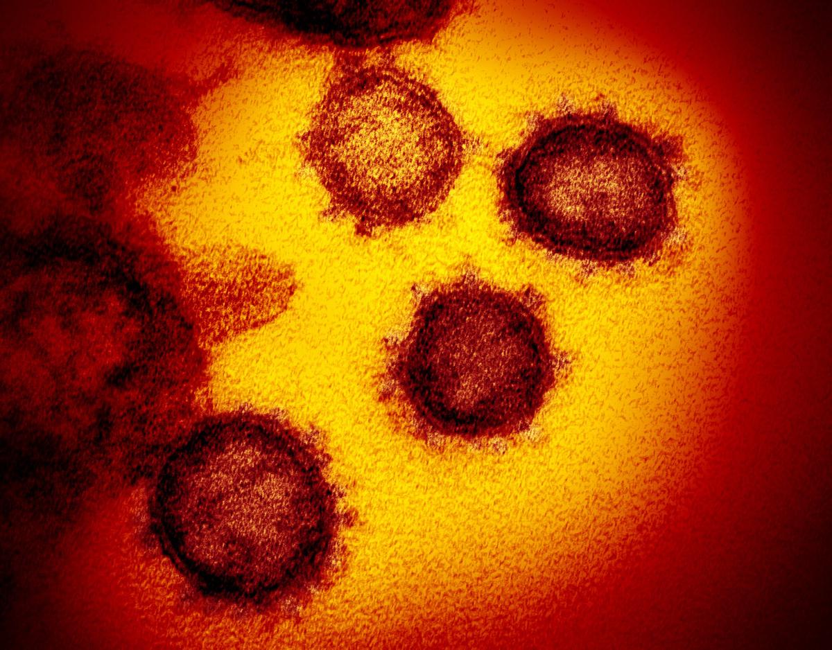 This transmission electron microscope image shows the virus that causes COVID-19 isolated from a patient in the United States, emerging from the surface of cells cultured in a lab in February 2020. (NIAID-RML/CC BY 2.0)