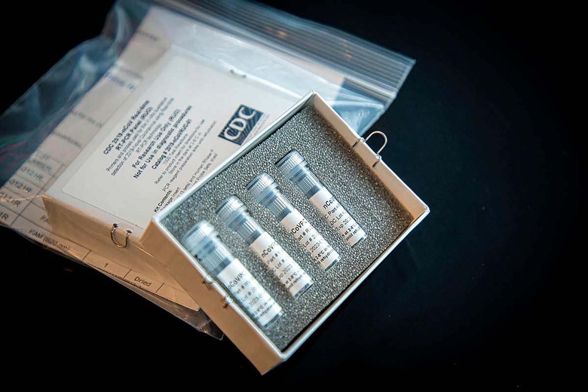 This undated photo provided by U.S. Centers for Disease Control and Prevention (CDC) shows CDC’s laboratory test kit for the new coronavirus. (CDC via AP)