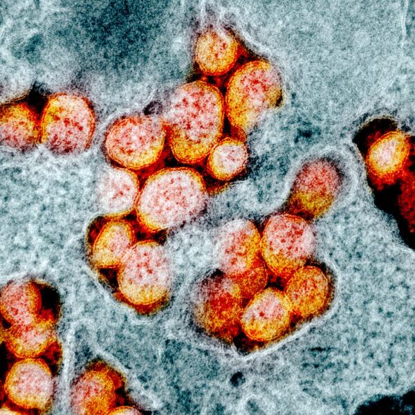 Transmission electron micrograph of the virus particles that causes COVID-19, isolated from a patient in February 2020. Image captured and color-enhanced at the NIAID Integrated Research Facility in Fort Detrick, Maryland. (NIAID/CC BY 2.0)