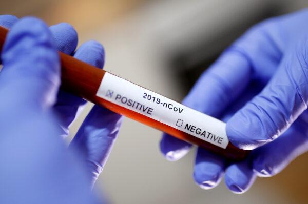 A test tube in an illustration picture. (Dado Ruvic/Reuters)