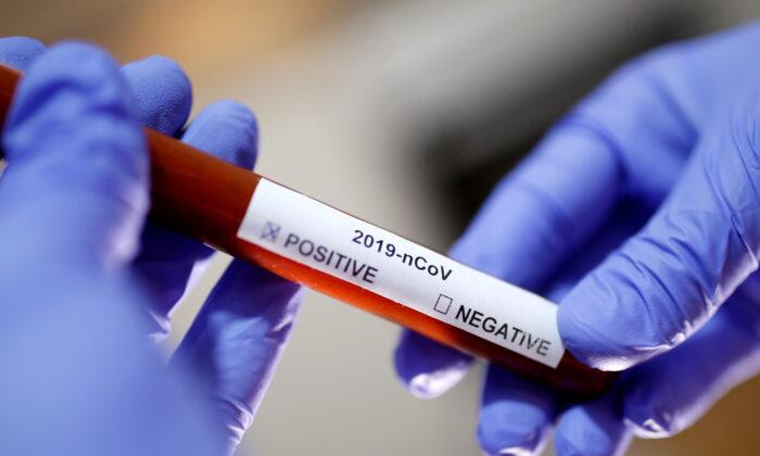 Labs in All 50 States Testing for New Coronavirus