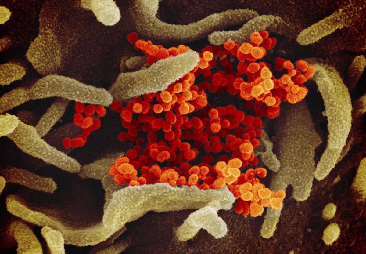 This scanning electron microscope image shows SARS-CoV-2 (orange)—also known as 2019-nCoV, the virus that causes COVID-19—isolated from a patient in the United States, emerging from the surface of cells (green) cultured in the lab. (NIAID-RML via AP)