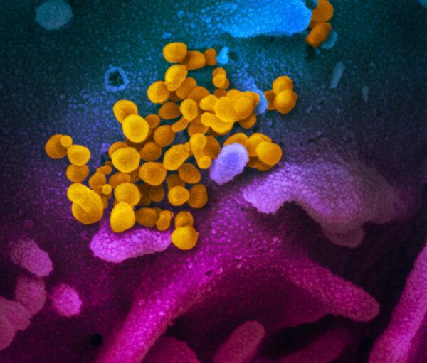 This scanning electron microscope image shows SARS-CoV-2 (yellow)—also known as 2019-nCoV, the virus that causes COVID-19—isolated from a patient in the United States, emerging from the surface of cells (blue/pink) cultured in the lab. (Courtesy of NIAID-RML)