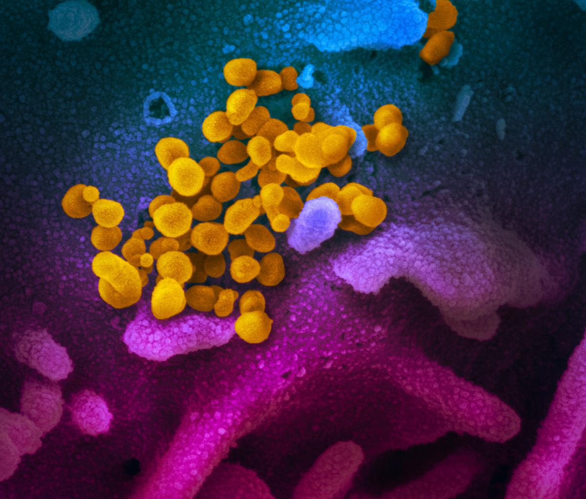 This scanning electron microscope image, published on Feb. 13, 2020, shows SARS-CoV-2 (yellow)—also known as 2019-nCoV, the virus that causes COVID-19—isolated from a patient in the United States, emerging from the surface of cells (blue/pink) cultured in the lab. (Courtesy of NIAID-RML)