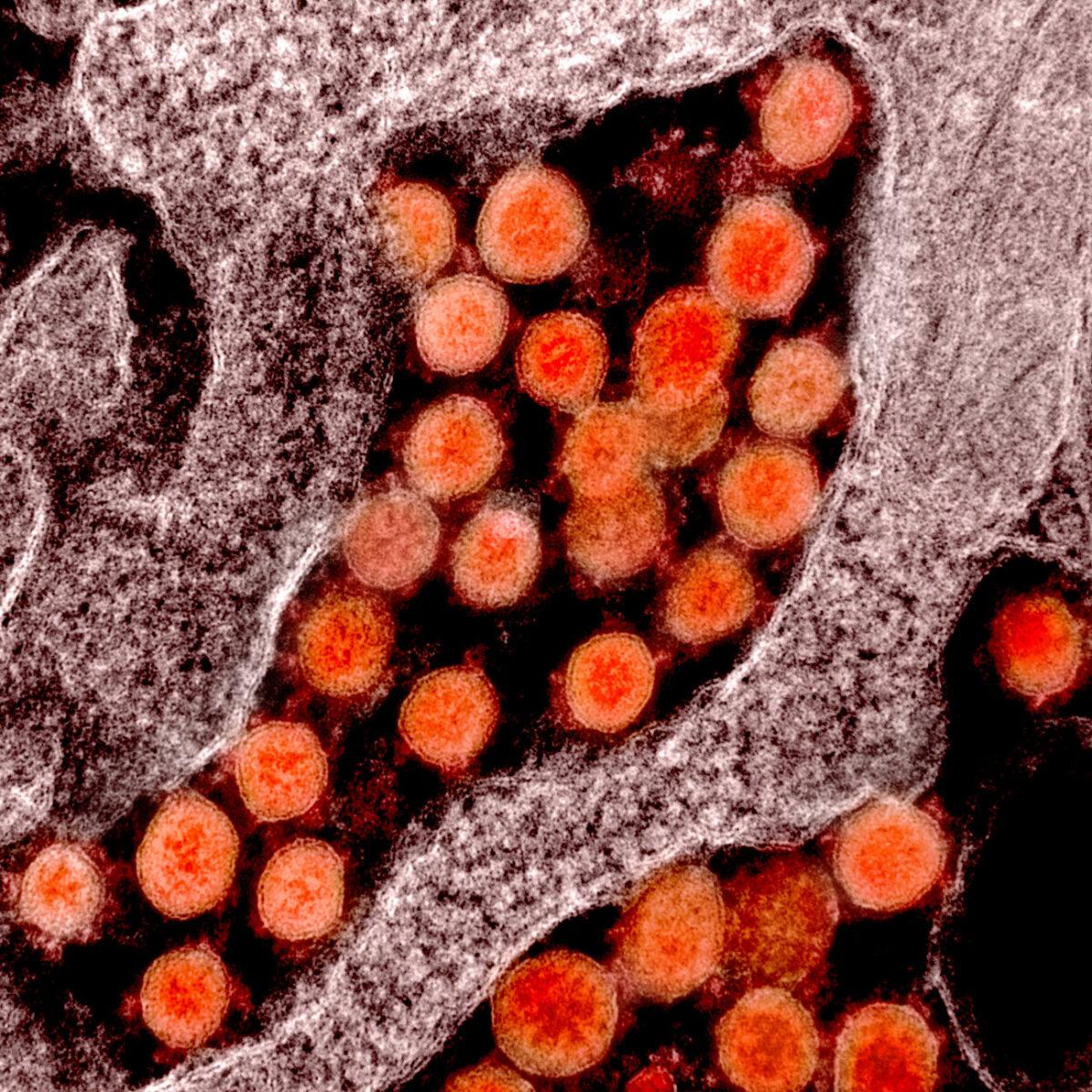 Transmission electron micrograph of particles of the CCP virus, commonly known as the novel coronavirus, isolated from a patient in the United States. (NIAID)