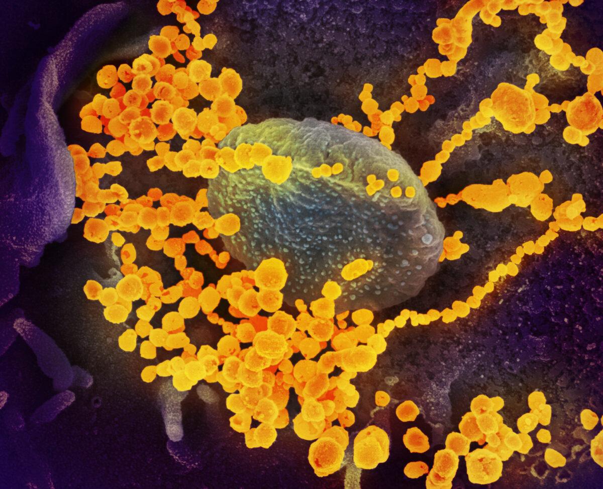 This scanning electron microscope image shows the CCP virus, (round yellowish objects) emerging from the surface of cells cultured in the lab. The virus shown was isolated from a patient in the United States. Photo published on Feb. 19, 2020. (NIAID-RML)