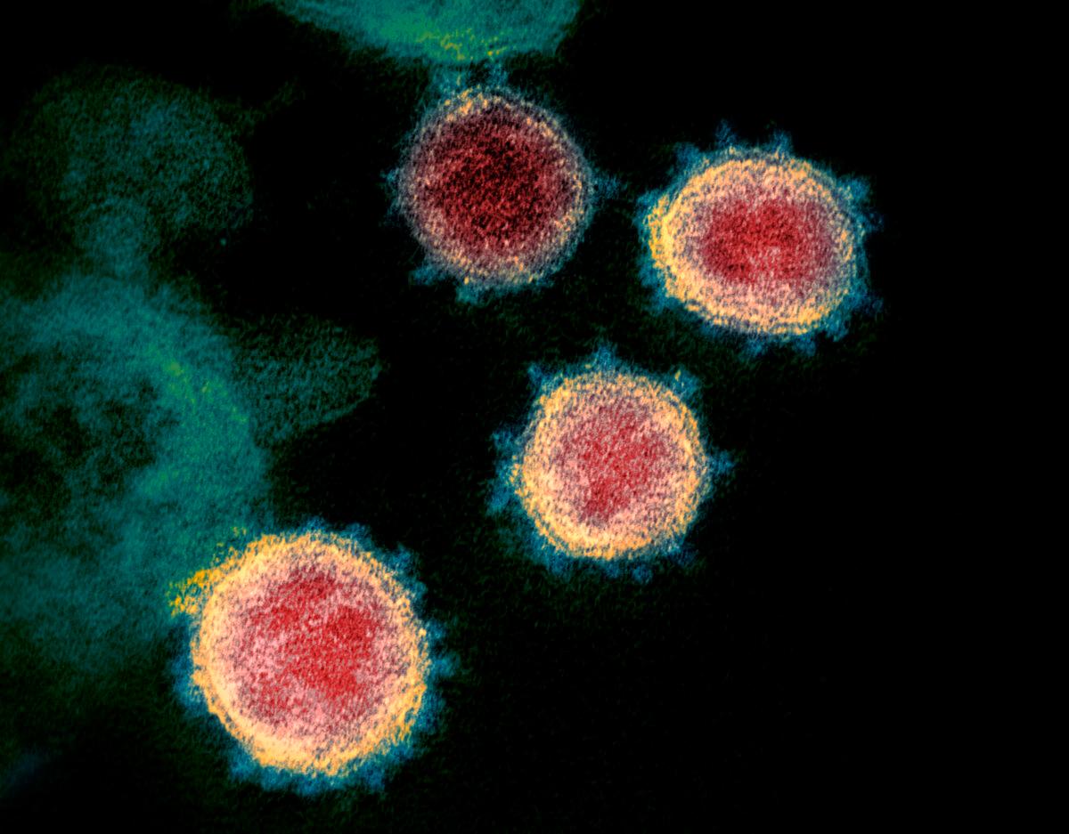  This undated electron microscope image made available by the U.S. National Institutes of Health in February 2020 shows the virus that causes COVID-19. The sample was isolated from a patient in the United States. (NIAID-RML via AP)