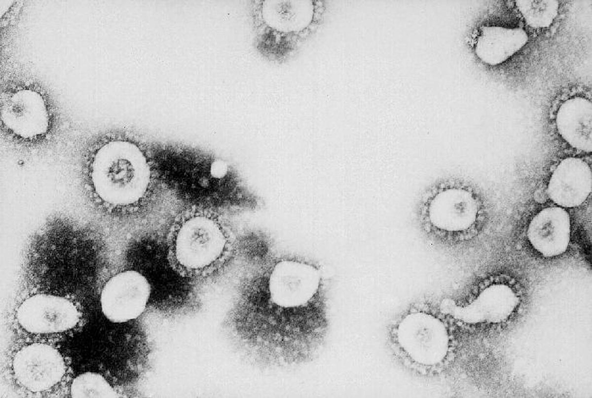 This photo from the Centers for Disease Control and Prevention (CDC) shows a microscopic view of the Coronavirus at the CDC in Atlanta, Georgia. (©<a href="https://www.gettyimages.com/detail/news-photo/this-undated-handout-photo-from-the-centers-for-disease-news-photo/1889380?adppopup=true">Getty Images</a>)