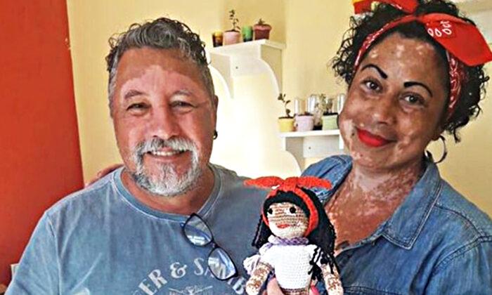 Grandpa Knits Dolls With Vitiligo for Kids Suffering From This Rare Skin Condition