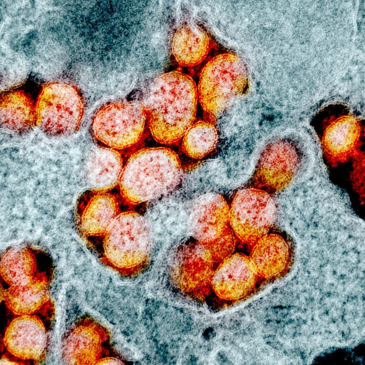 Transmission electron micrograph of SARS-CoV-2 virus particles, which The Epoch Times refers to as the CCP virus, isolated from a patient. (NIAID)