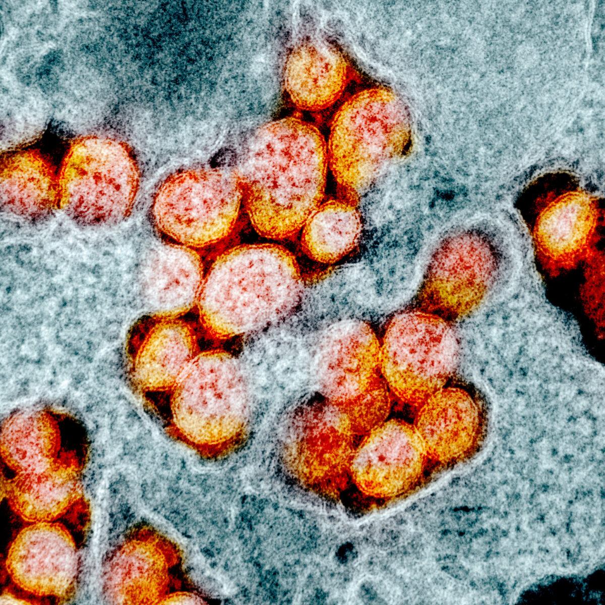 Transmission electron micrograph of SARS-CoV-2 virus particles, isolated from a patient. Image captured and color-enhanced at the NIAID Integrated Research Facility (IRF) in Fort Detrick, Md. (NIAID)