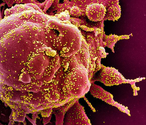 Colorized scanning electron micrograph of an apoptotic cell (red) heavily infected with coronavirus particles (yellow), isolated from a patient sample. Image captured at the NIAID Integrated Research Facility (IRF) in Fort Detrick, Md., published on April 2, 2020. (NIAID)