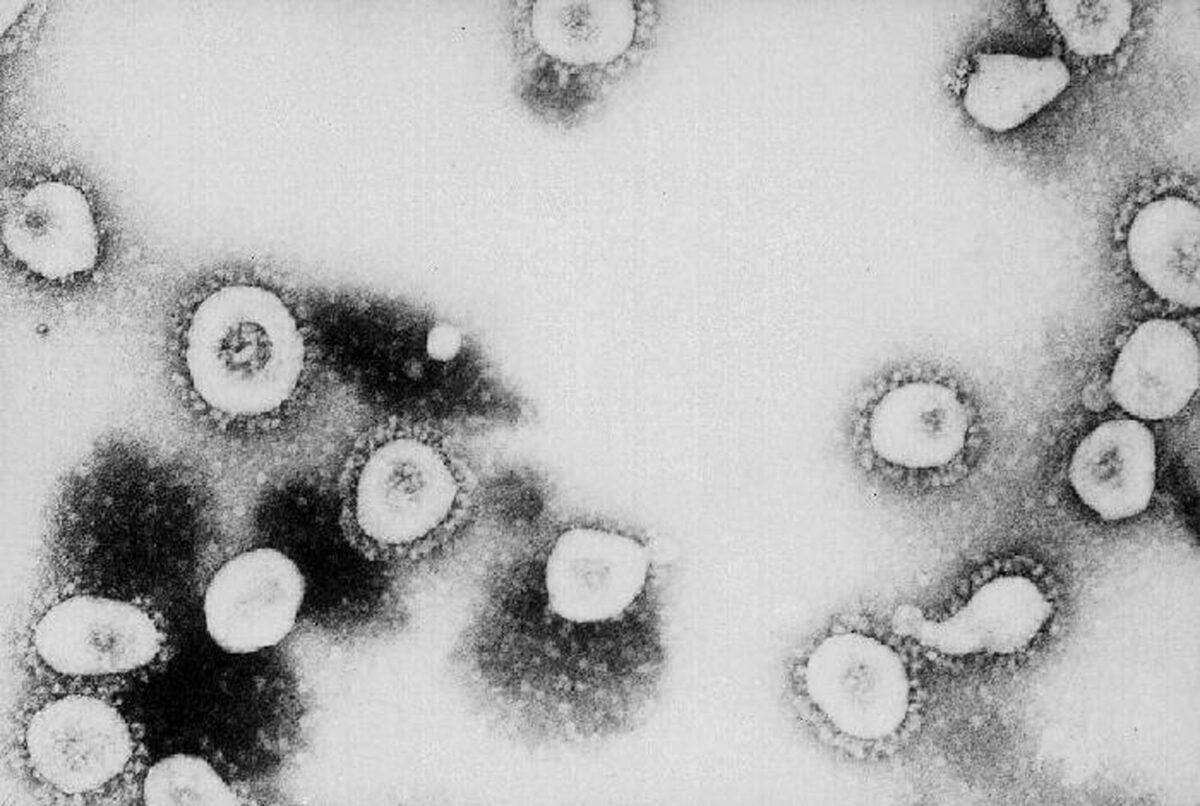 ATLANTA, GA - UNDATED: This undated handout photo from the Centers for Disease Control and Prevention (CDC) shows a microscopic view of the novel coronavirus at the CDC in Atlanta, Georgia. (©Getty Images | <a href="https://www.gettyimages.com/detail/news-photo/this-undated-handout-photo-from-the-centers-for-disease-news-photo/1889380?adppopup=true">CDC</a>)
