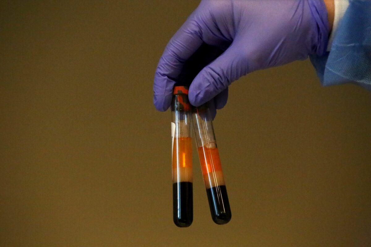 A phlebotomist shows specimens of people getting tested for CCP virus antibodies at the Refuah Health Center in Spring Valley, New York, on April 24, 2020. (Yana Paskova/Getty Images)