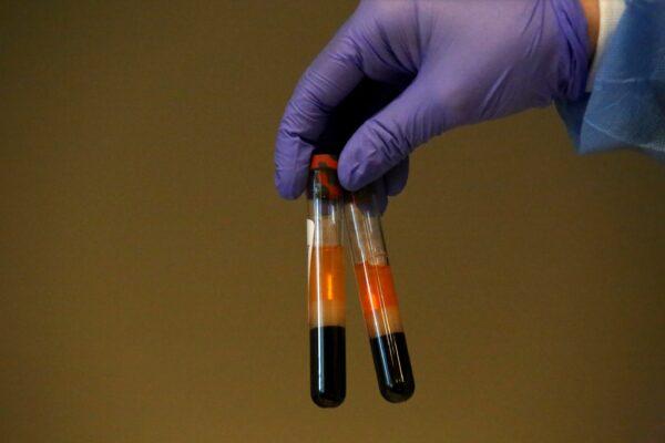 A phlebotomist shows specimens from people being tested for CCP virus antibodies at the Refuah Health Center in Spring Valley, New York, on April 24, 2020. (Yana Paskova/Getty Images)